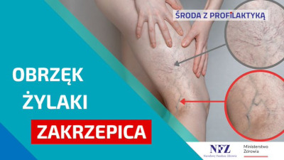 Zdjęcie: noga pokryta zylakami. Tekst w ramce: Obrzęk żylaki zakrzepica